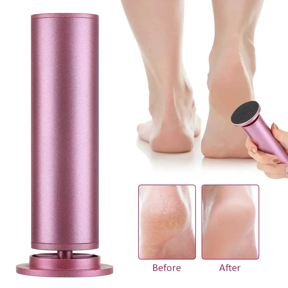 USB Charge Electric Foot Callus Remover Dead Skin Pedicure Tool Professional Callus Remover for Feet with 20PCS Sandpaper Disc from PriceLows™