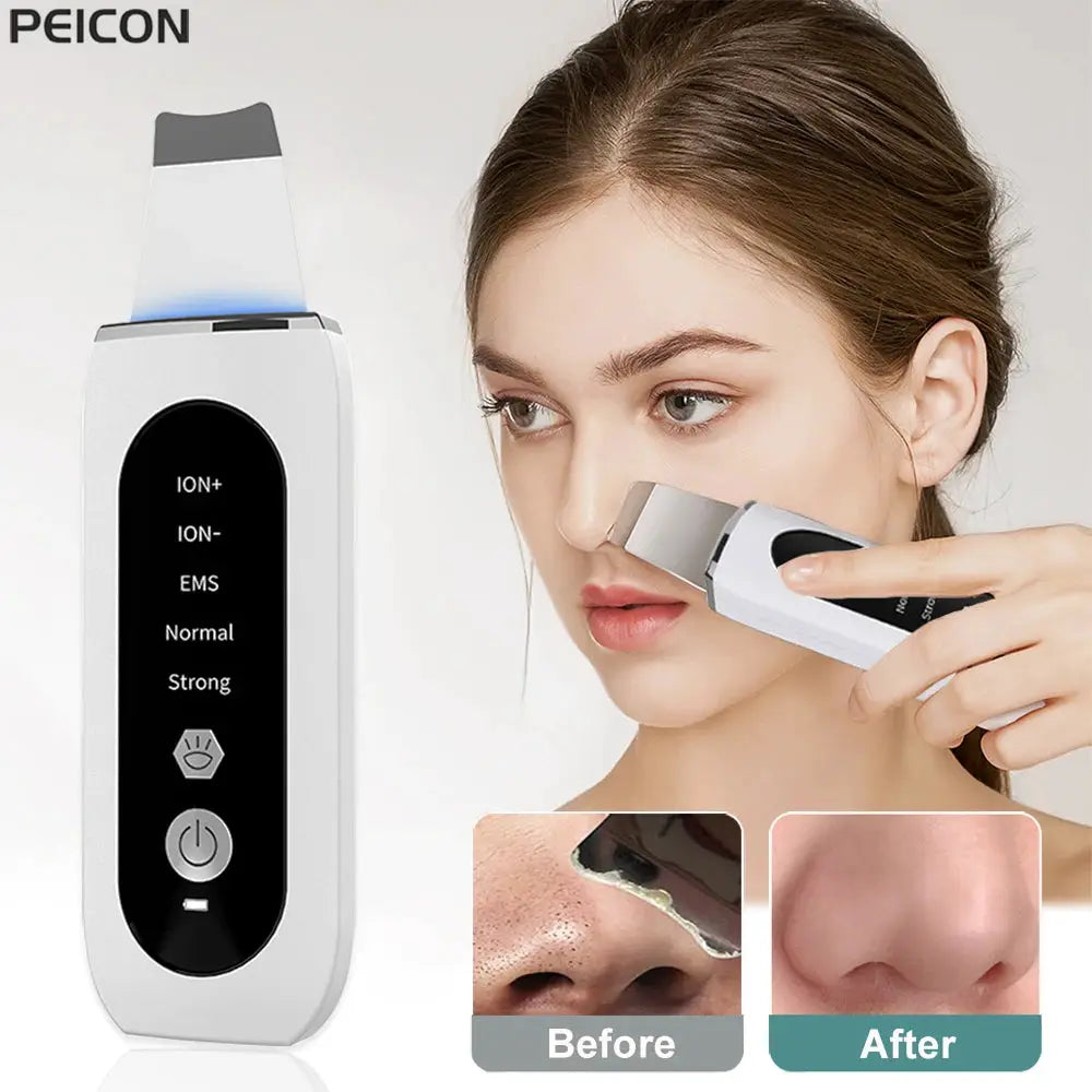 Ultrasonic Skin Scrubber Peeling Blackhead Remover Deep Face Cleaning Ultrasonic Ion Ance Pore Cleaner Facial Shovel Cleanser from PriceLows™