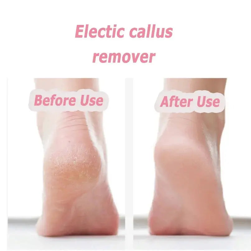 Portable Electric Foot Heel Care Tool Pedicure tool Pedicure Feet Heels Skin Remover Cuticle File Set USB Pedicure For Men Women from PriceLows™