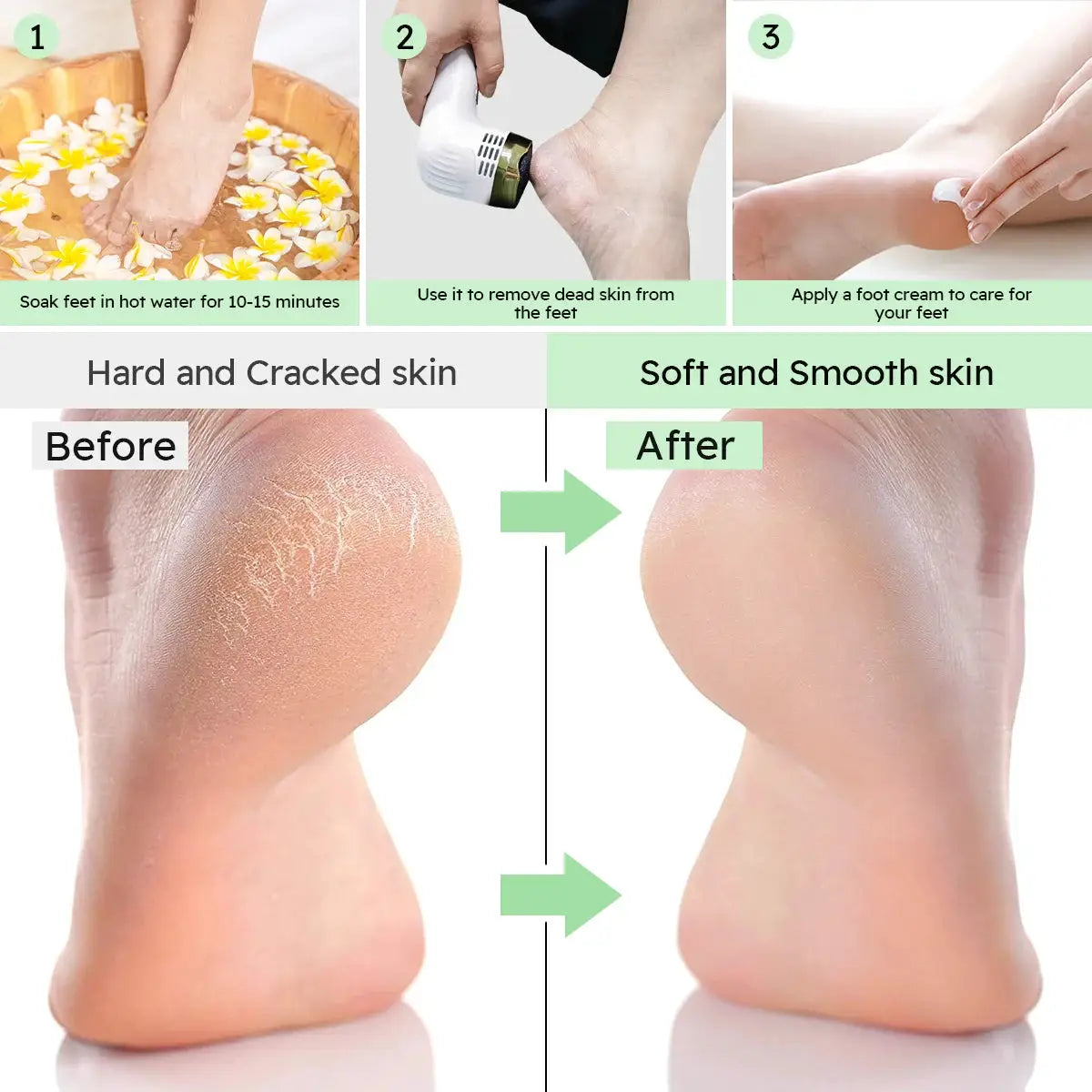 Rechargeable Foot Callus Remover Electric Pedicure Tool with Vacuum 6 Replaceable Heads USB Charging from PriceLows™