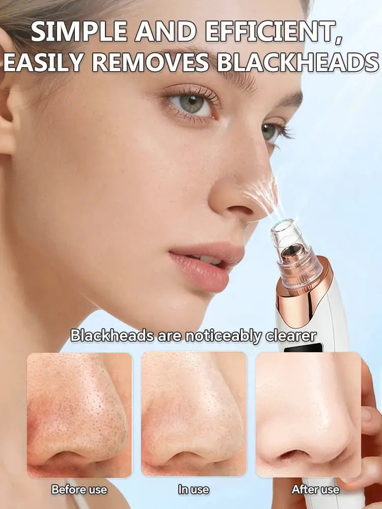 Electric Blackhead Remover Vacuum Cleaner Black Dots Vacuum Cleaner Skin Pimple Acne Extractor Facial Cleaning Electric from PriceLows™