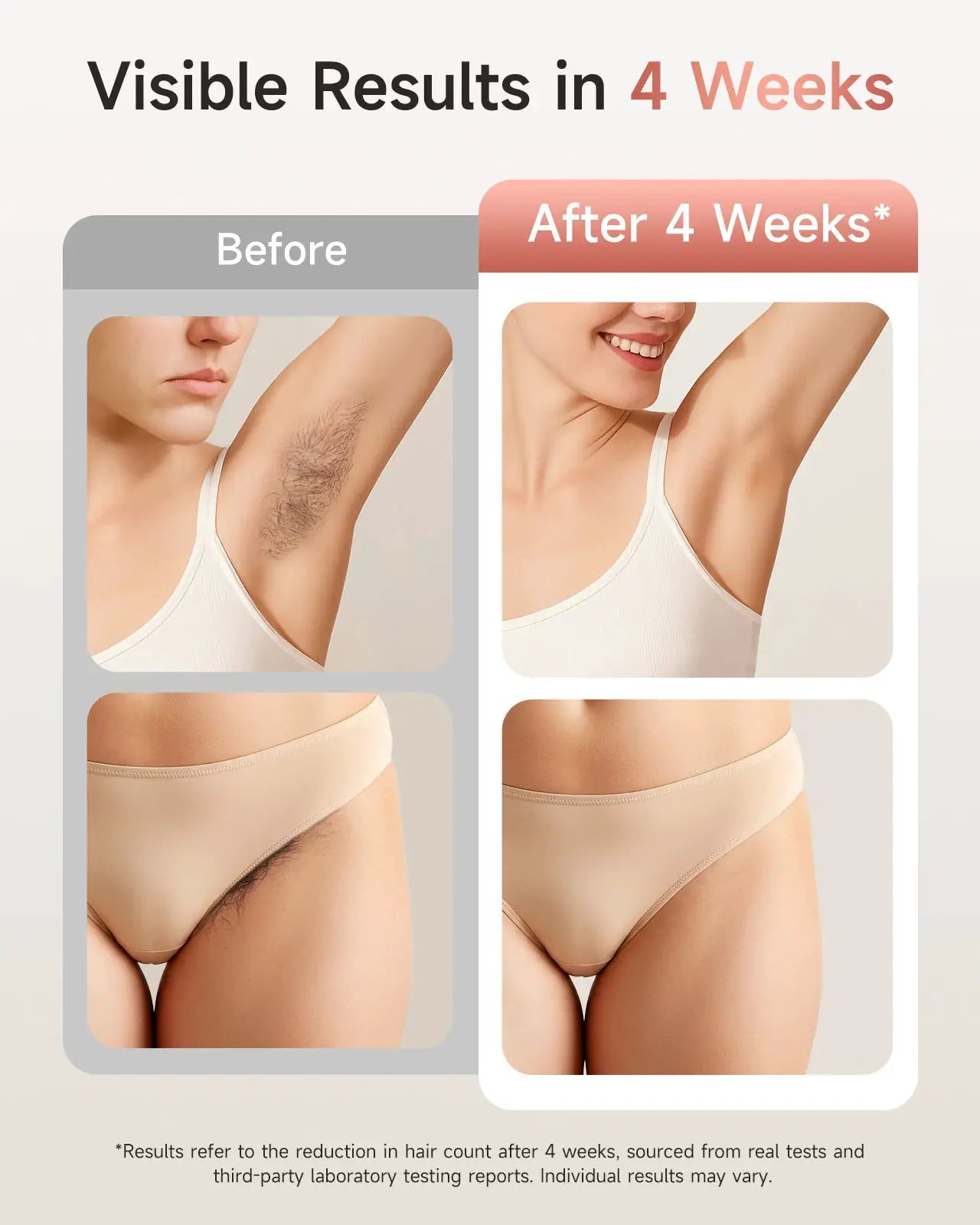 Lysmoski IPL Hair Removal Device | 9 Energy Levels | Acne Treatment | Home Use