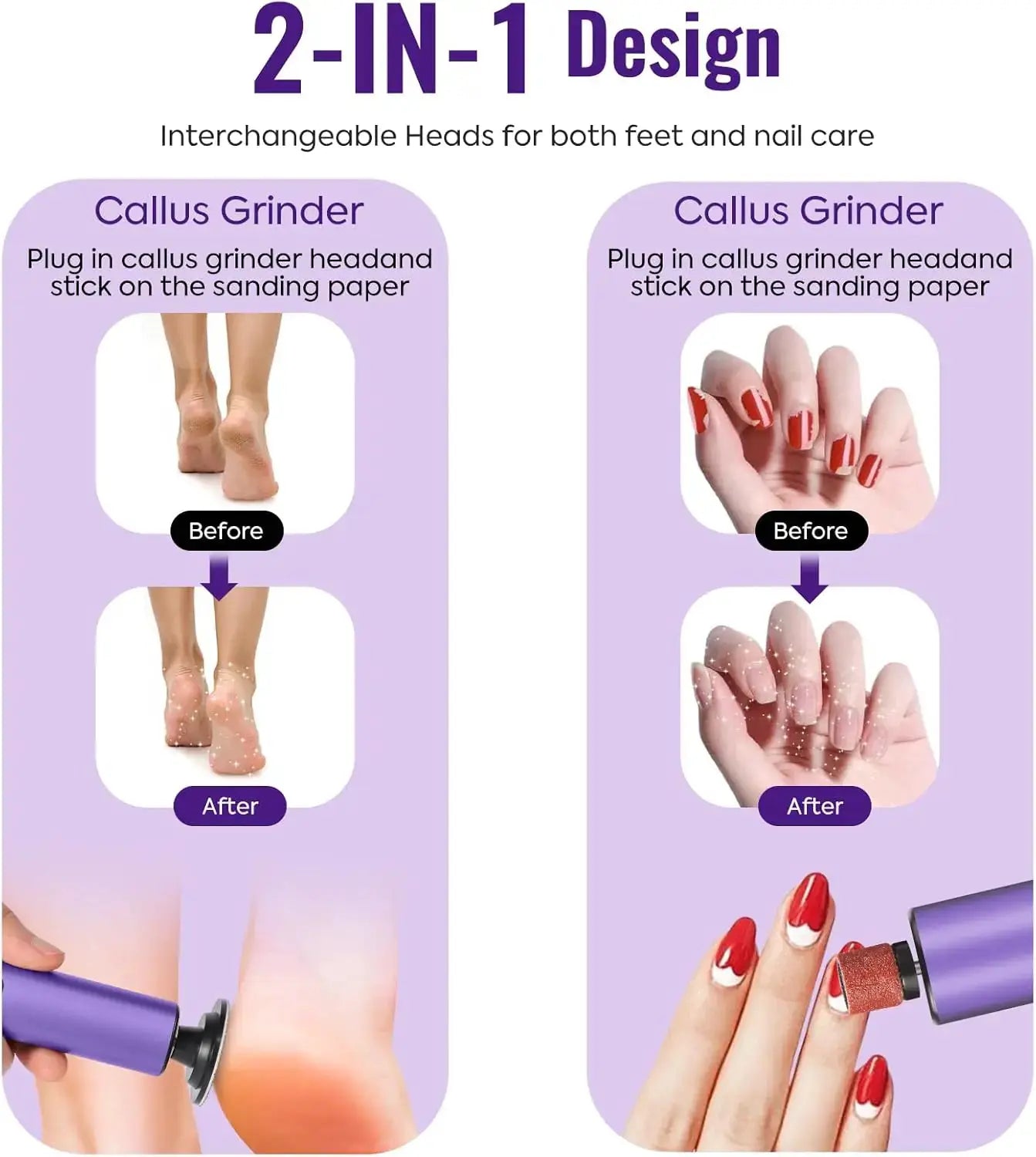 Electric Foot Callus Remover 2-in-1 Electric Foot File Grinder Nail Polisher 9-Speed Feet Pedicure Tool for Dead Skin & Cracked from PriceLows™