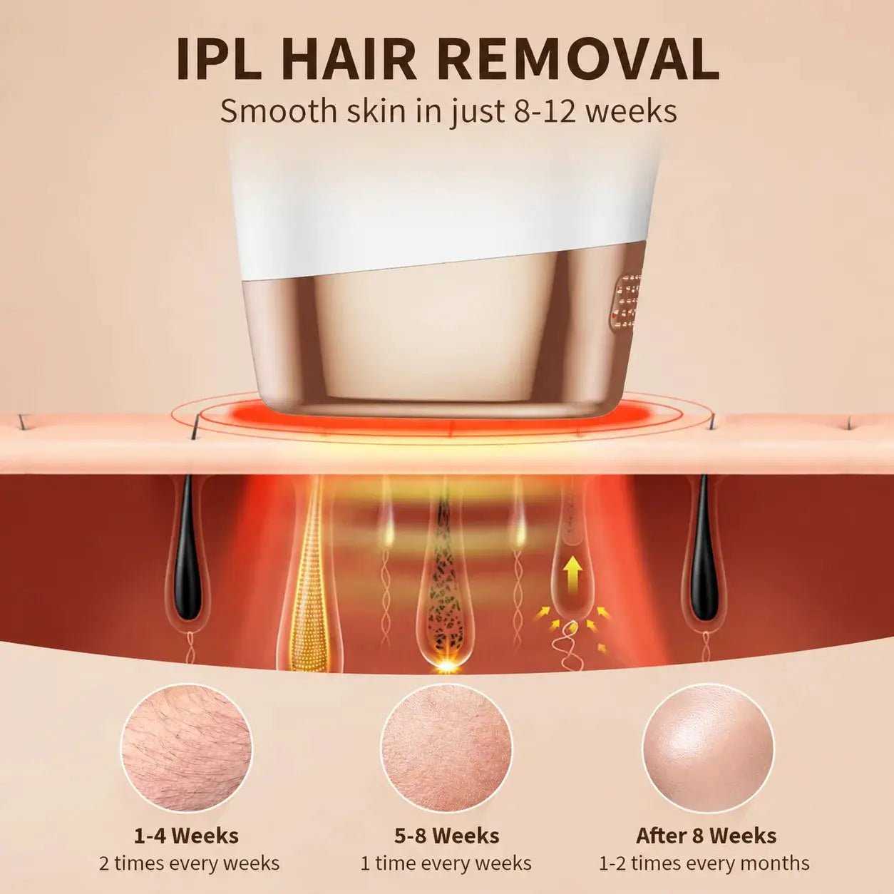 Lysmoski Ipl Hair Removal Device | 999900 Flashes | 9 Energy Levels | Permanent Hair Remover