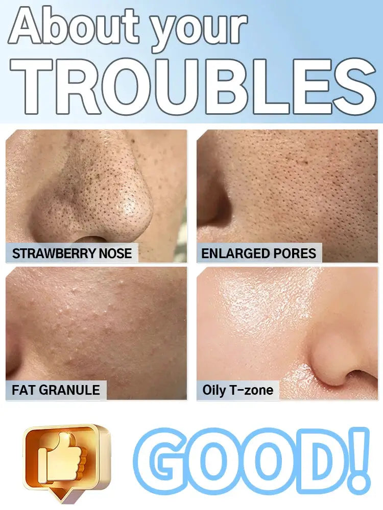 Electric Blackhead Remover Vacuum Cleaner Black Dots Vacuum Cleaner Skin Pimple Acne Extractor Facial Cleaning Electric from PriceLows™