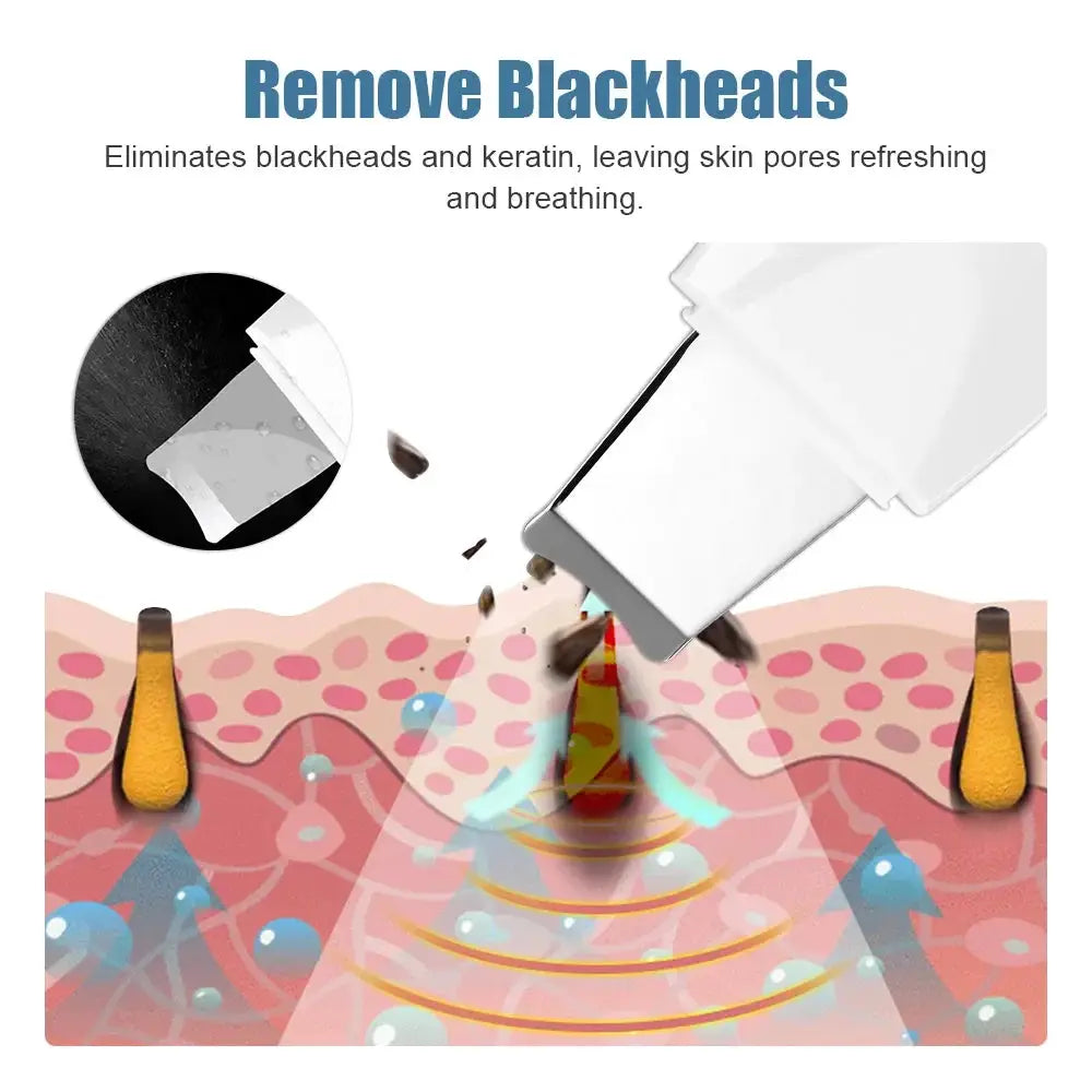 Ultrasonic Skin Scrubber Peeling Blackhead Remover Deep Face Cleaning Acne Pore Cleaner Facial Shovel Cleanser EMS Microcurrent from PriceLows™