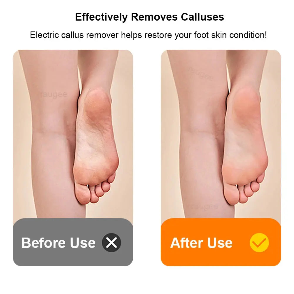 Electric Foot Grinder Mini Portable Foot Callus Remover USB Rechargeable Foot Exfoliation Predicure Grinding Dead Skin Remover from PriceLows™