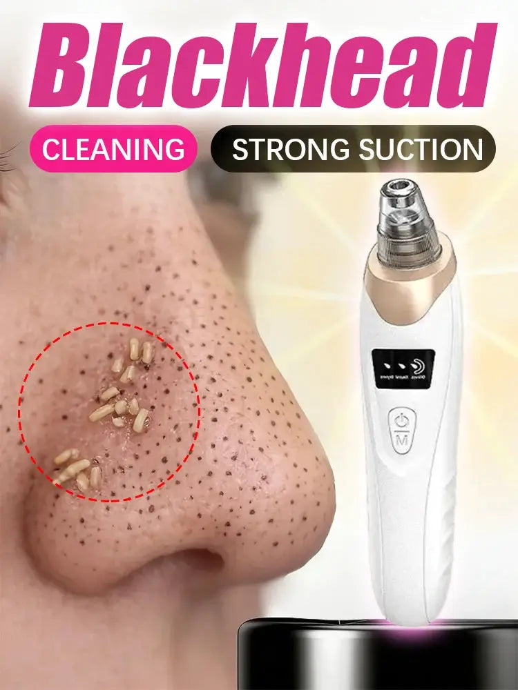 Blackhead Remover pimples and blackheads vacuum pores removal facial skin cleansing device For Deep cleaning home from PriceLows™