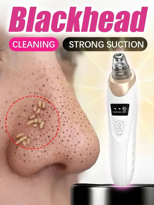 Blackhead Remover pimples and blackheads vacuum pores removal facial skin cleansing device For Deep cleaning home from PriceLows™