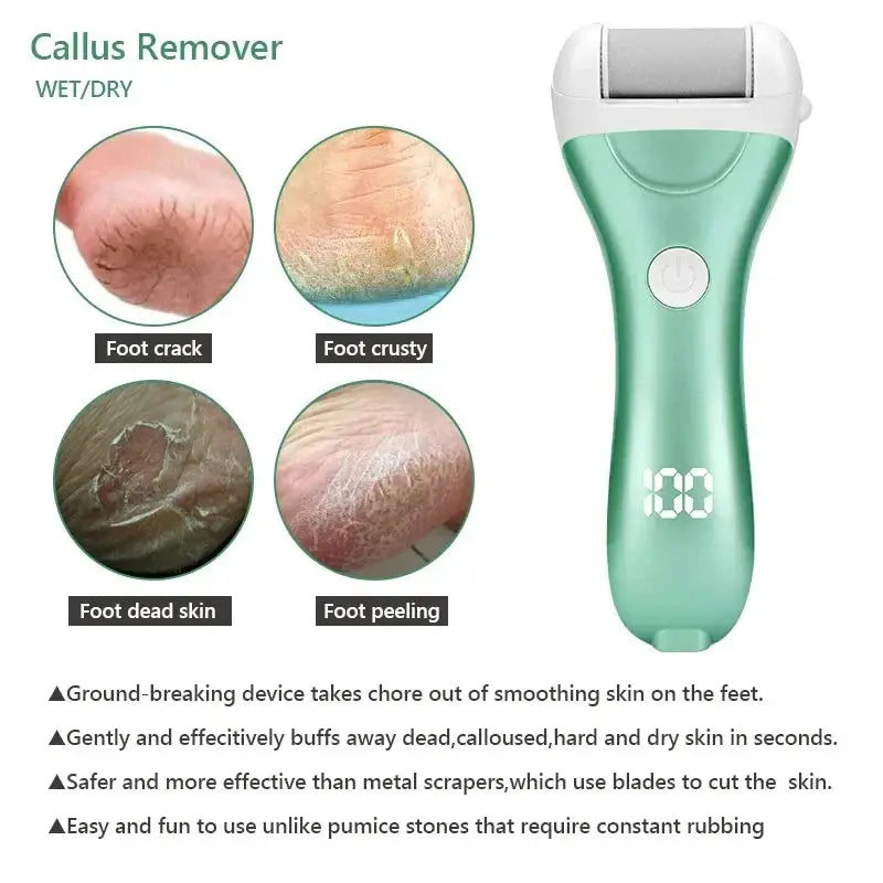 Electric Pedicure Foot File USB Rechargeable Power Display 3pcs Grinding Exfoliator Replacement Heads For Heel Callus Remover from PriceLows™
