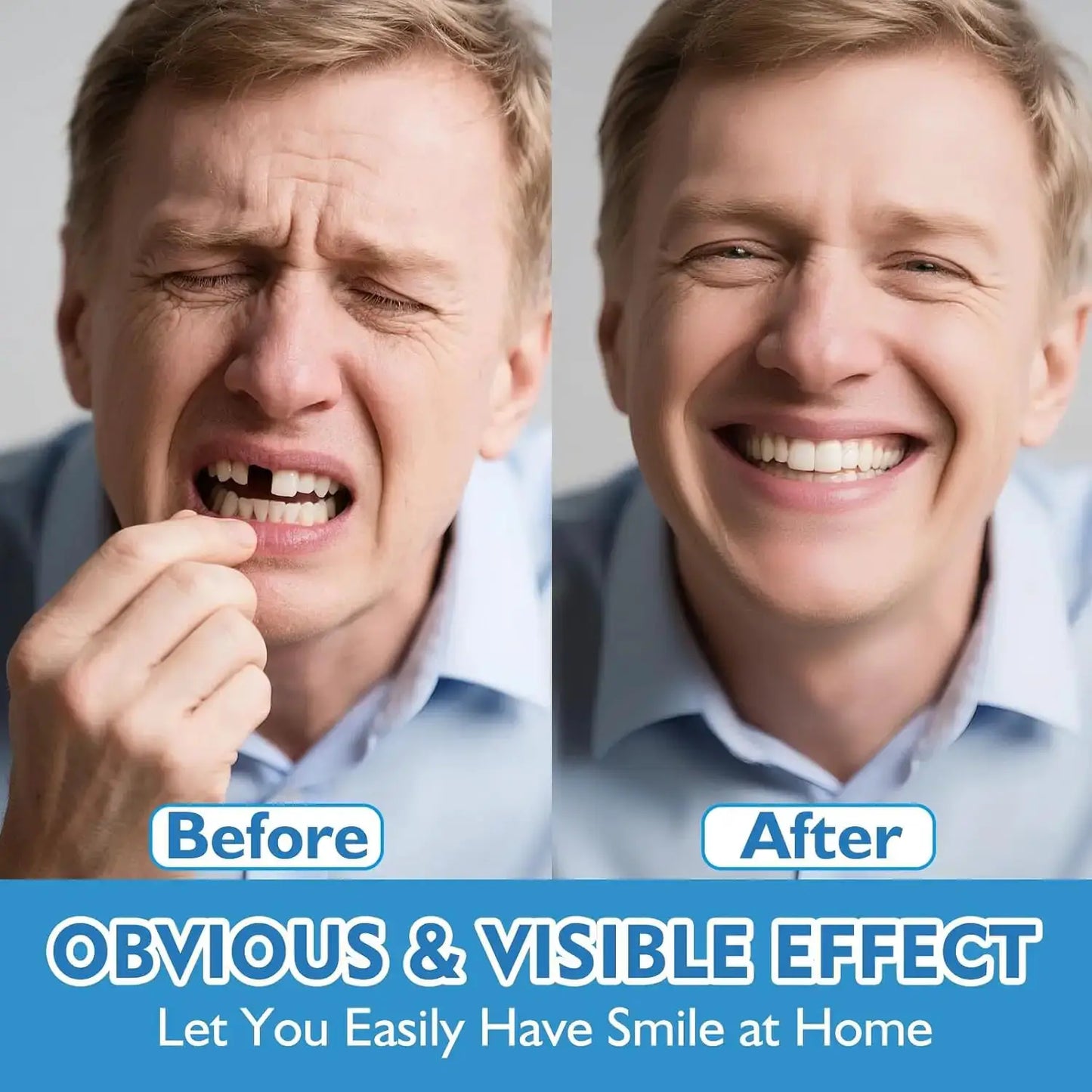 Natural Silicone Denture Set | Full Upper And Lower | Comfort Fit Design