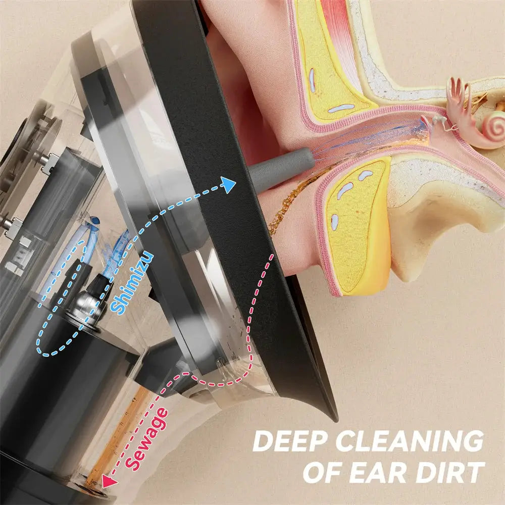 Electric Ear Wax Removal System Water Powered Ear Cleaning Tool with Irrigation Flusher 3 Pressure Settings Safe & Effective from PriceLows™