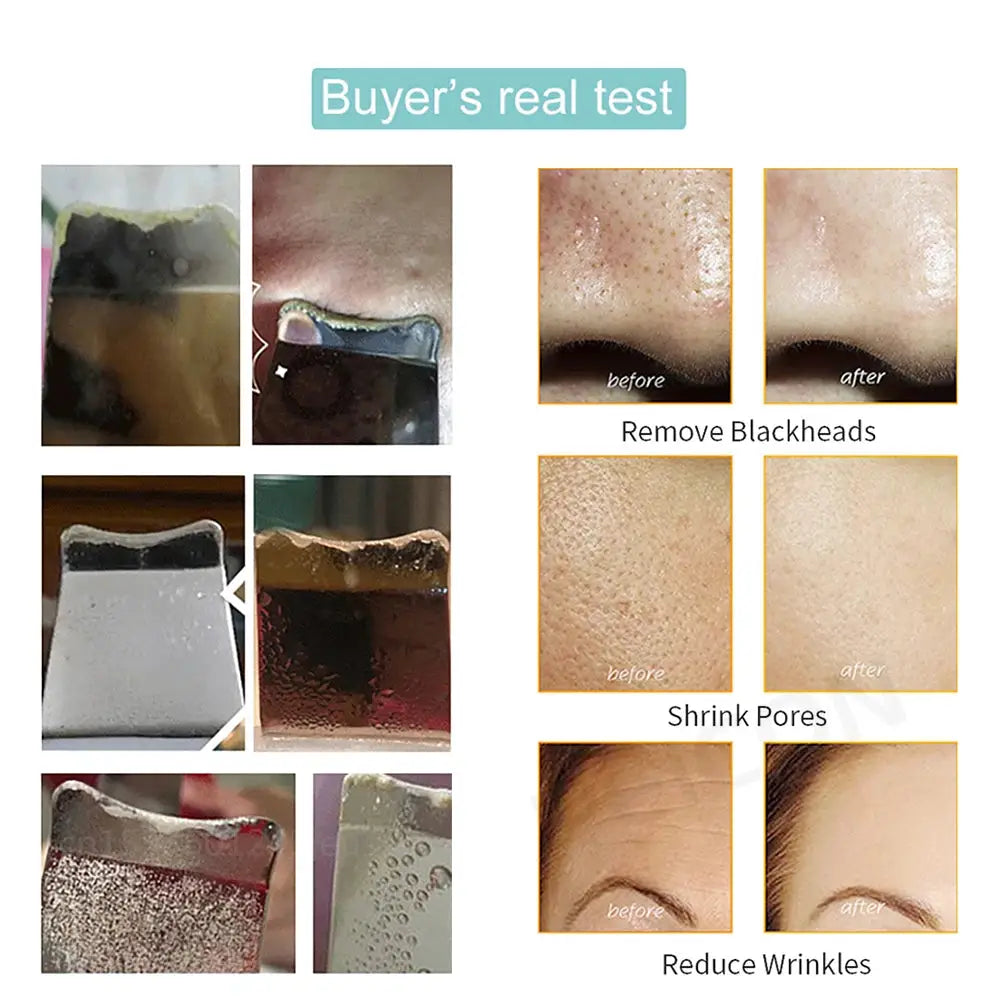 Ultrasonic Skin Scrubber Peeling Blackhead Remover Deep Face Cleaning Ultrasonic Ion Ance Pore Cleaner Facial Shovel Cleanser from PriceLows™