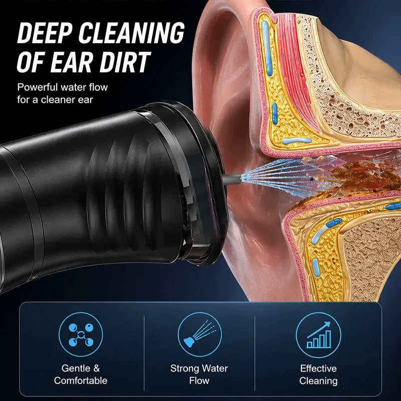 Electric Ear Wax Removal Irrigation System 3 Pressure Settings Water Powered Ear Cleaner with Dual 2in1 Water Tank for Home Use from PriceLows™