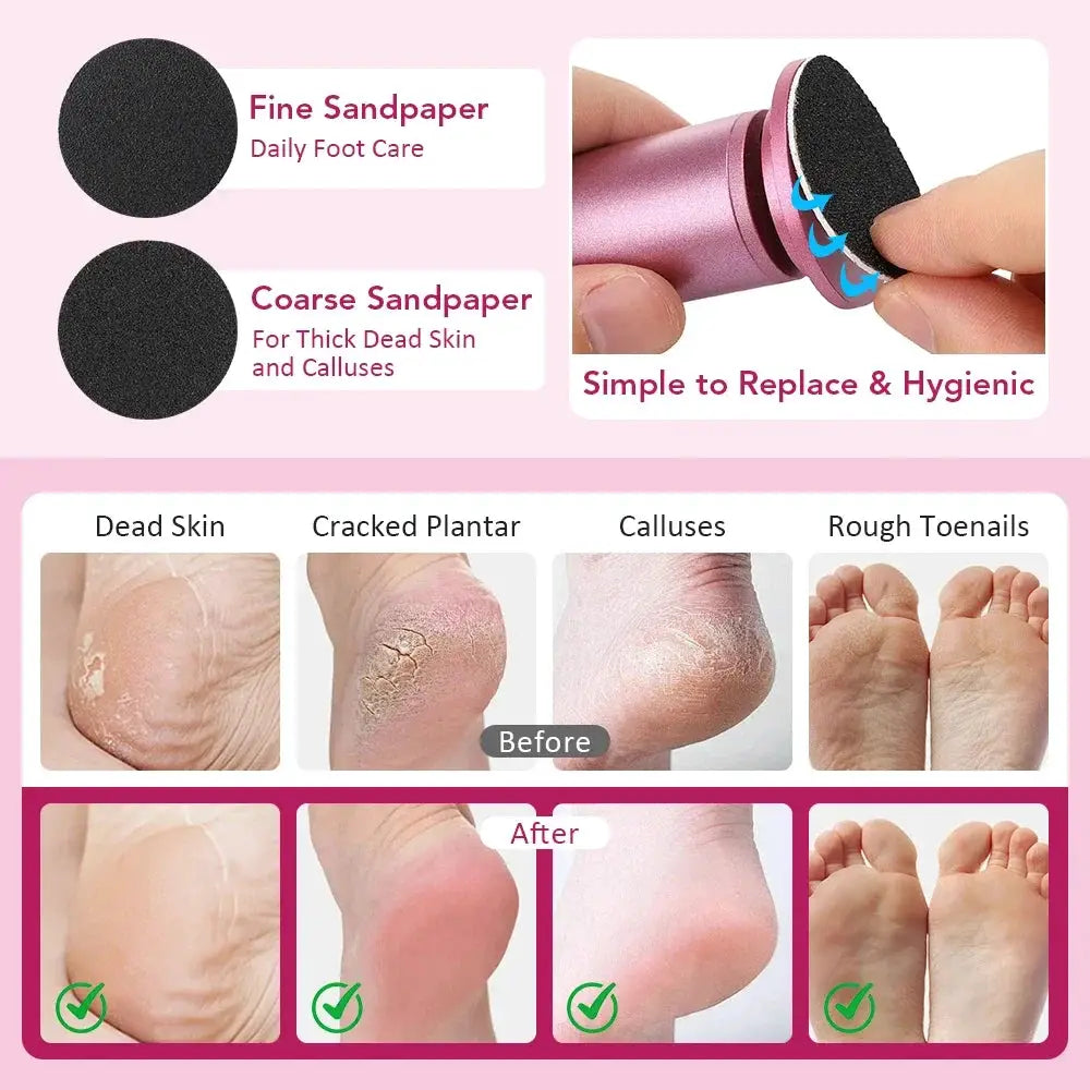 Electric Foot Callus Remover Foot Care File Leg Heels Remove Dead Skin Pedicure Tool Set Foot Grinder & Replacement Sandpaper from PriceLows™