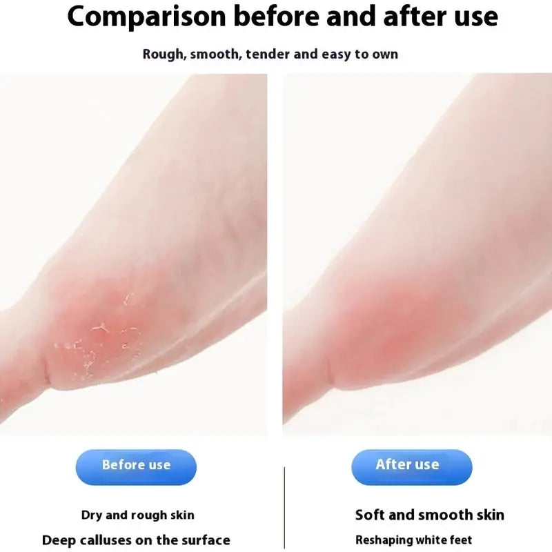 Household Electric Foot Grinder Dead Skin Remover Calluses Feet Scrubber Electric Foot File Dry Dead Cracked Foot Care Repaire from PriceLows™