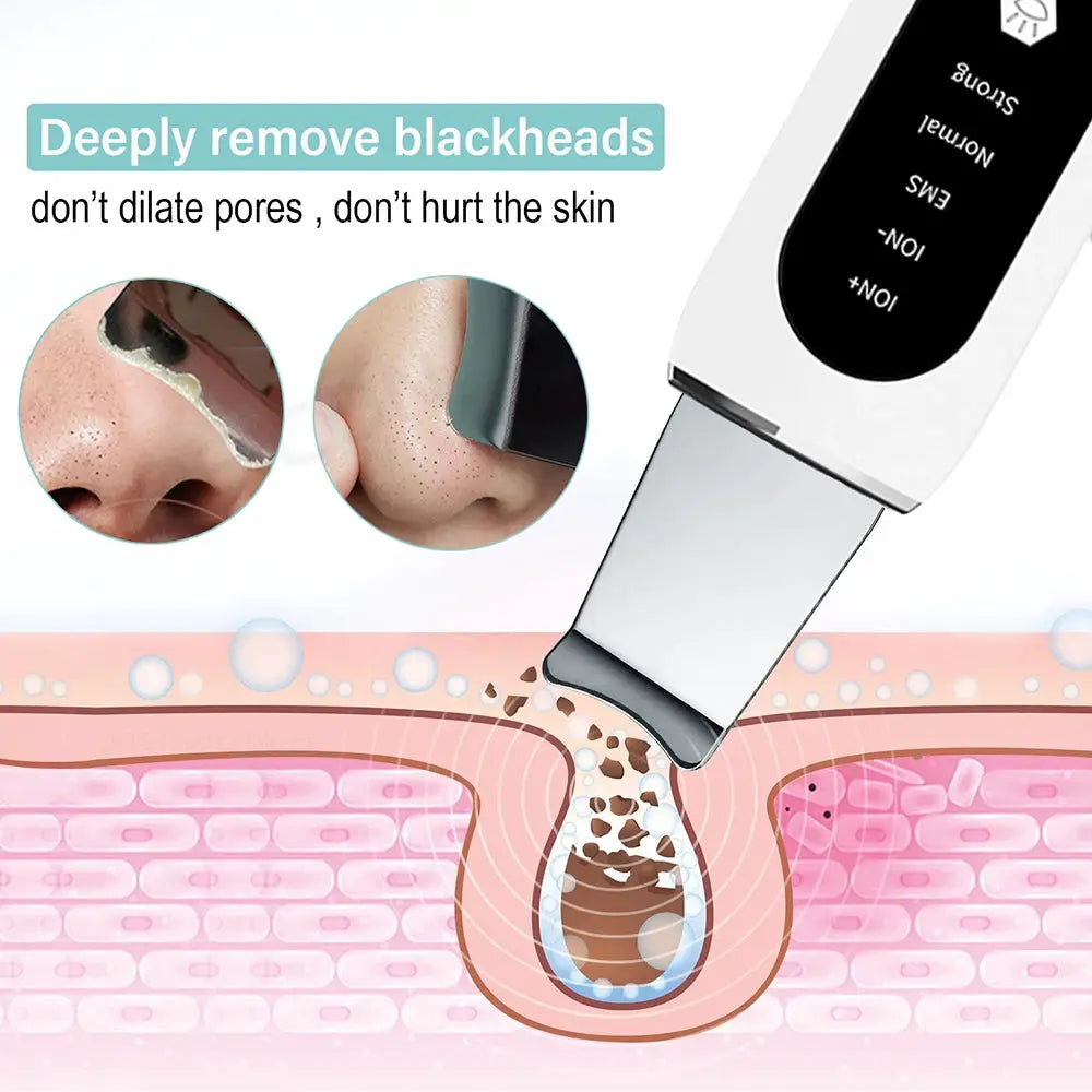 Ultrasonic Skin Scrubber Peeling Blackhead Remover Deep Face Cleaning Ultrasonic Ion Ance Pore Cleaner Facial Shovel Cleanser from PriceLows™