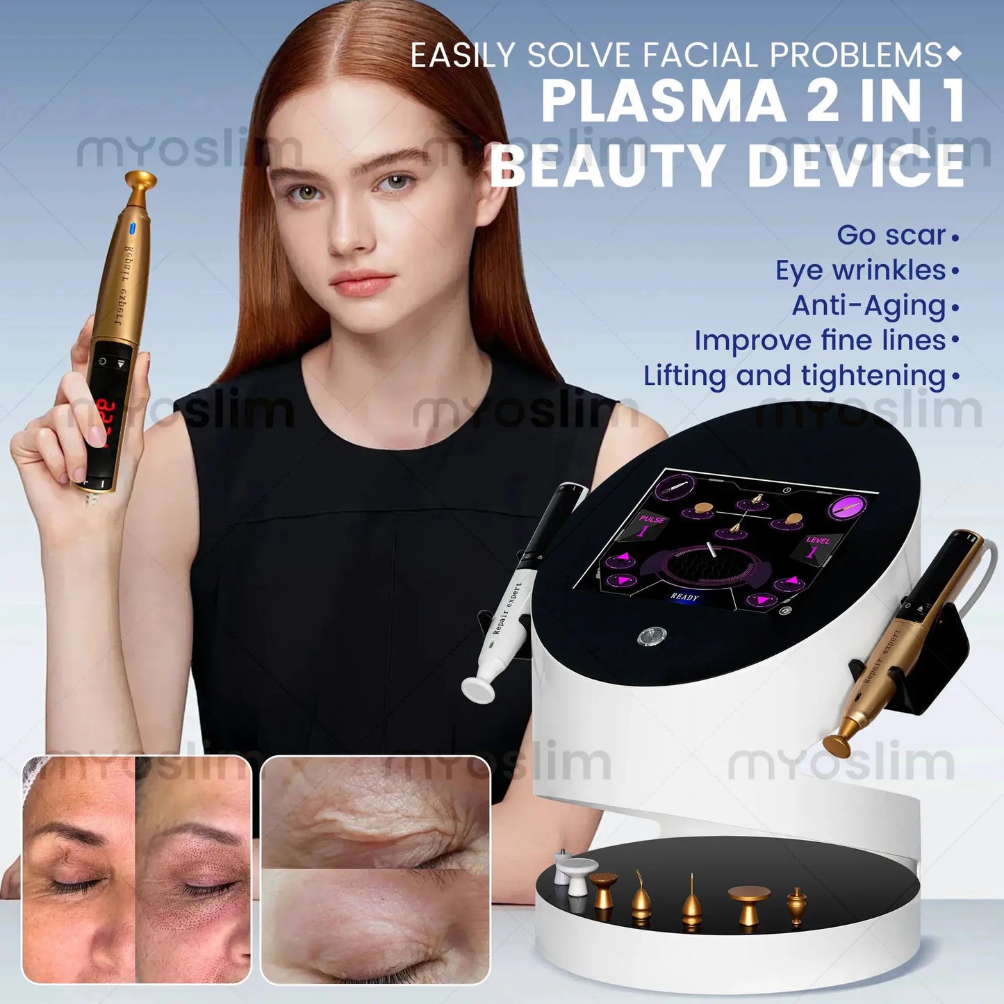 Plasma Facial Device | Ozone Gold Treatment | Skin Lifting And Spot Removal | Home Use