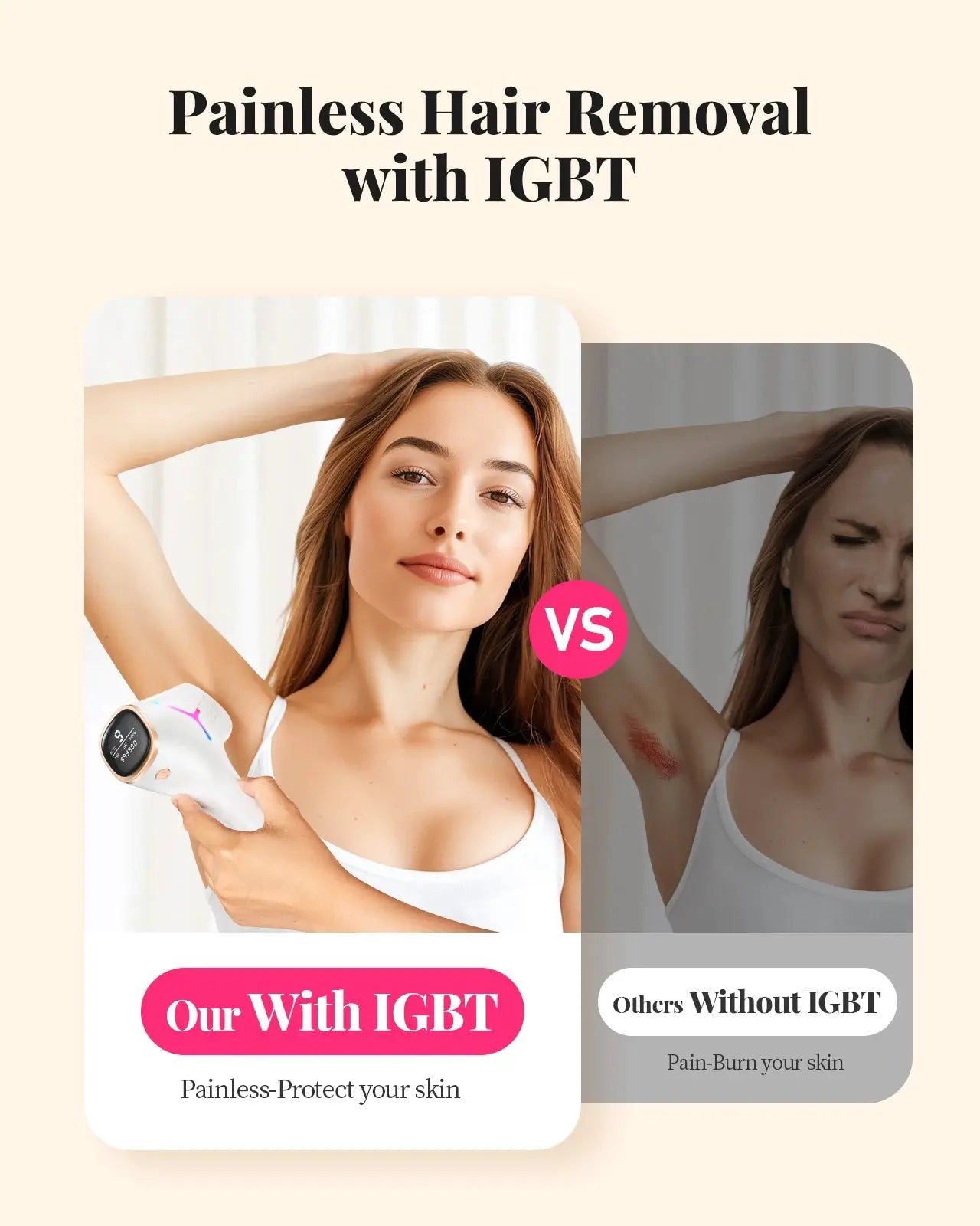 Totmizby IPL Hair Removal | 990,000 Flashes | Body and Face | Painless Permanent