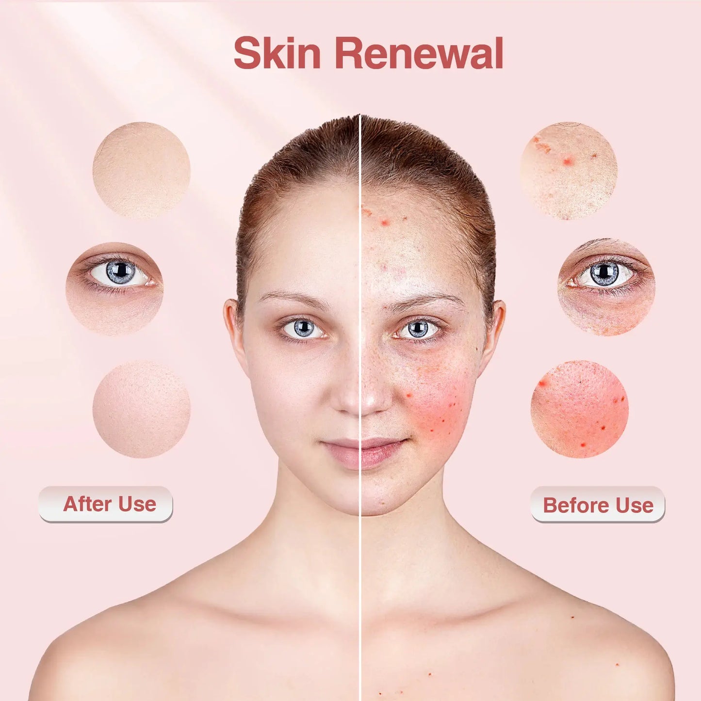 Red Light Therapy Photon Mask Hello Face M500S LED 630nm 850nm Near-Infrared Light Therapy Facial Mask Professional Beauty Care from PriceLows™