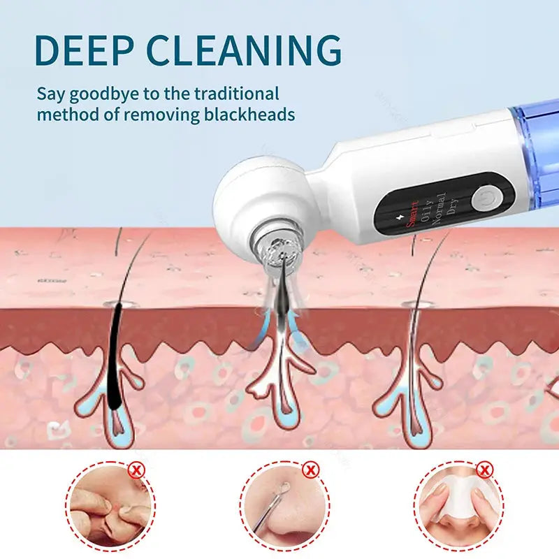 2025 New Blackhead Remover Pore Vacuum With Hot Compress Electric Facial Hydrating Cleaner Pimple Extractor Face Beauty Device from PriceLows™