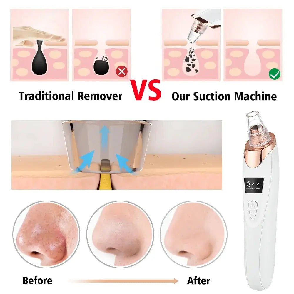 Blackhead Remover Vacuum Pore Adsorber Face Cleaner Electric Pimple Acne Black Head Removal Rechargeable Face Cleaning Tool from PriceLows™