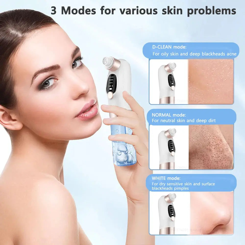 Blackhead Remover Pore Vacuum Face Cleaner Electric Pimple Acne Black Head Removal USB Rechargeable Water Cycle Black Dot Remove from PriceLows™