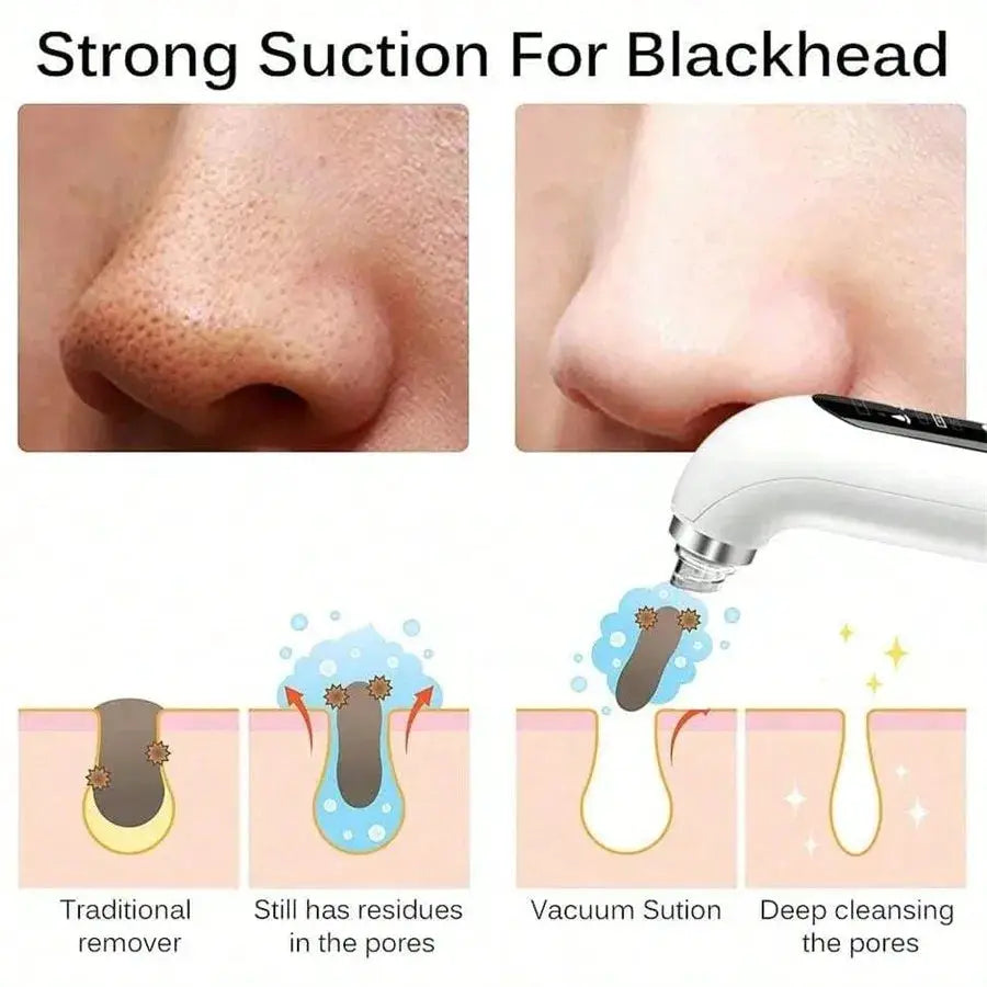 Face Beauty Pore Vacuum Facial Cleaner, Blackhead Remover, USB Charging Water Circulation Facial Cleaning Tool from PriceLows™