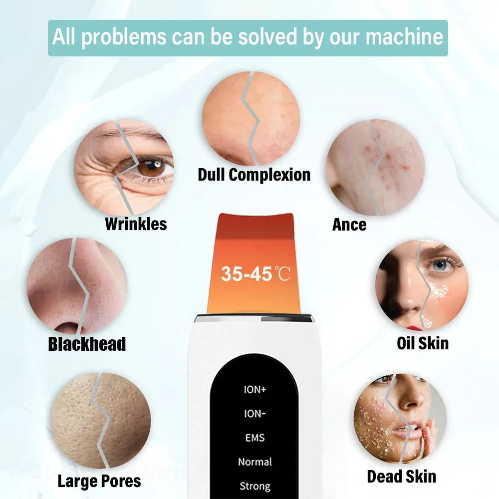 Ultrasonic Skin Scrubber Peeling Blackhead Remover Deep Face Cleaning Ultrasonic Ion Ance Pore Cleaner Facial Shovel Cleanser from PriceLows™