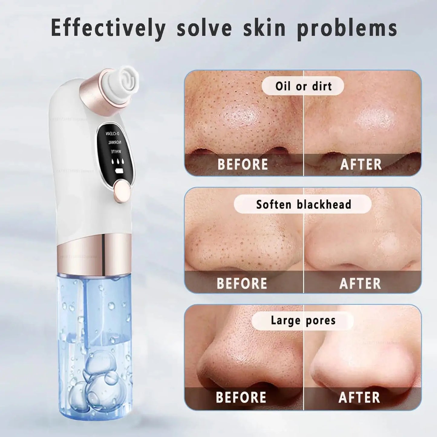 Blackhead Remover Pore Vacuum Face Cleaner Electric Pimple Acne Black Head Removal USB Rechargeable Water Cycle Black Dot Remove from PriceLows™