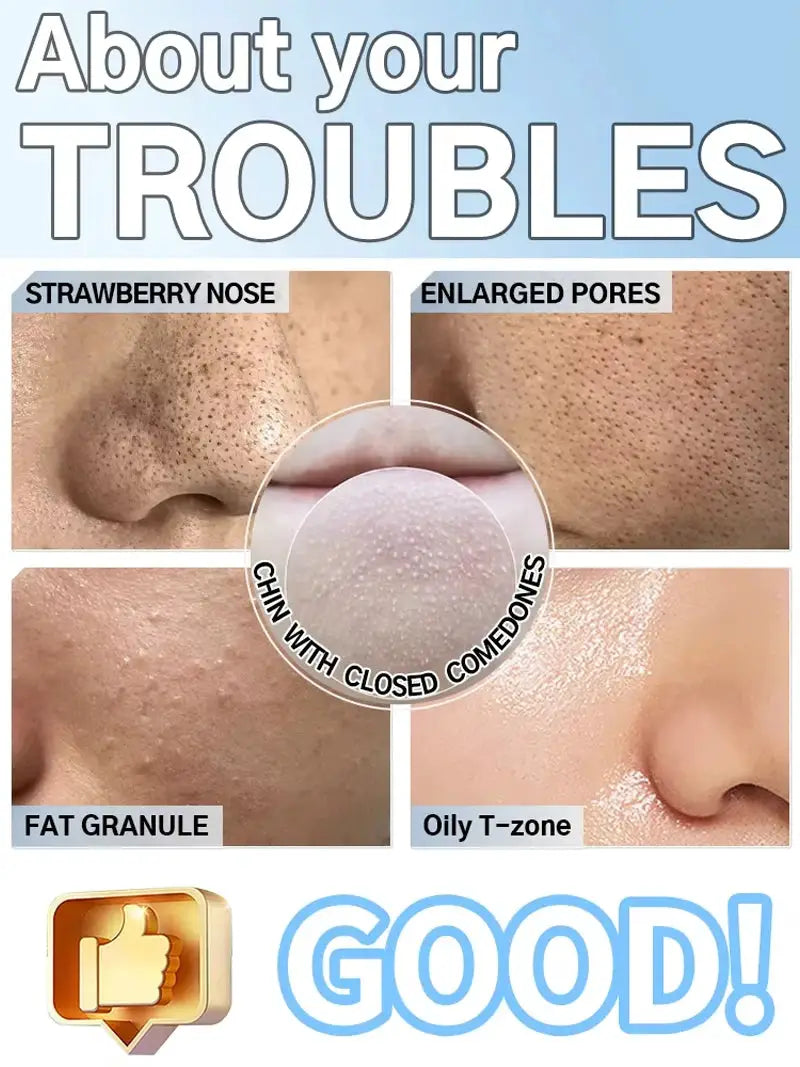 Blackhead Remover Pore Cleaner Black Dots Vacuum Cleaner Skin Pimple Acne Extractor Facial Cleaning Electric Black Head Removal from PriceLows™