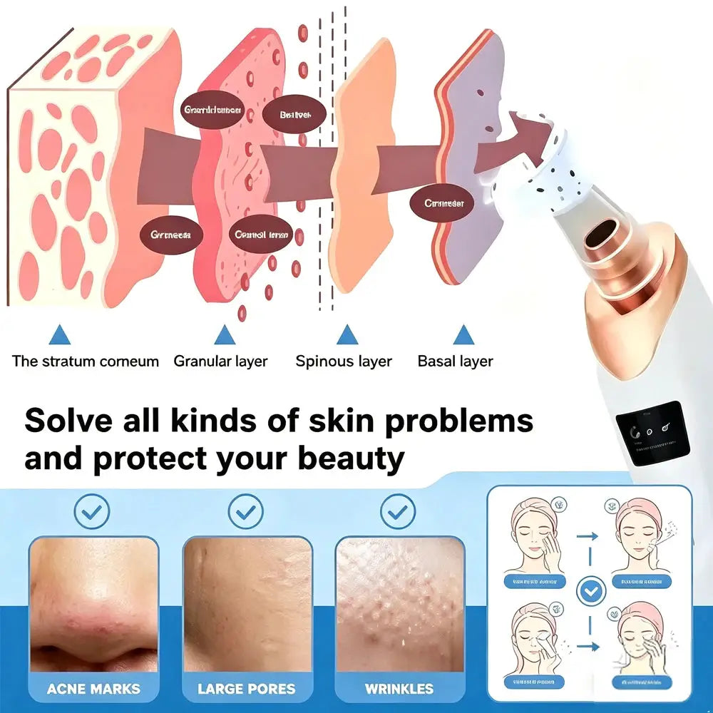 Electric Blackhead Remover Vacuum Acne Cleaner Black Dots Removal Facial Deep Cleansing Pore Cleaner Machine Skin Care Tools from PriceLows™
