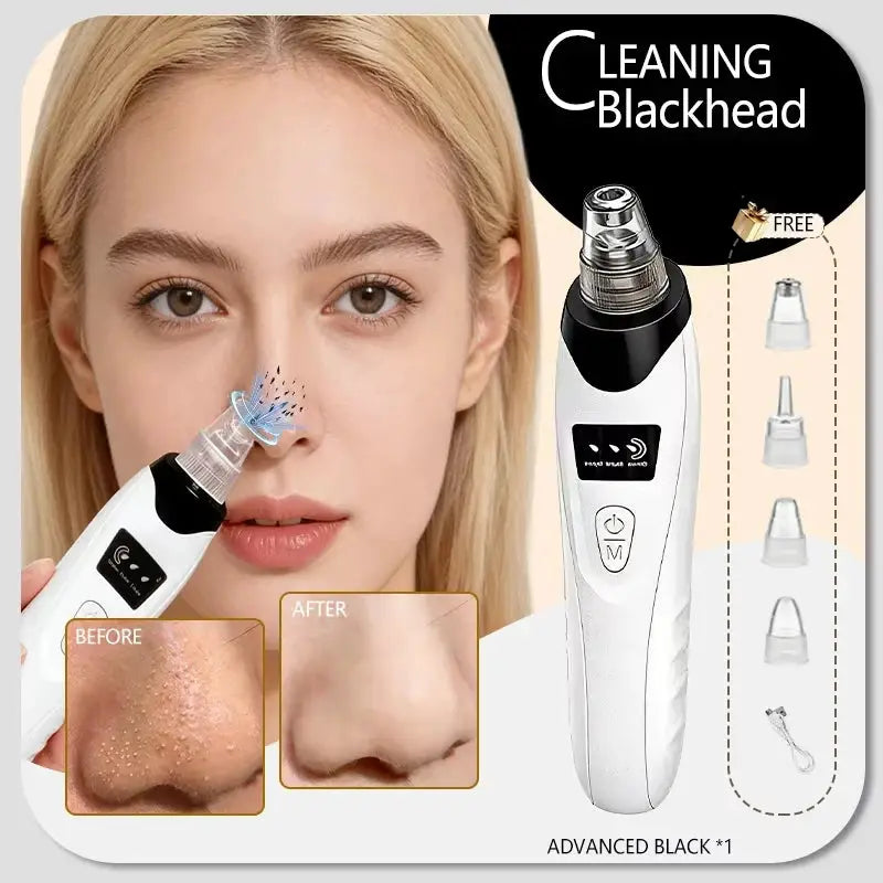 Blackhead Remover Pore Cleaner Black Dots Vacuum Cleaner Skin Pimple Acne Extractor Facial Cleaning Electric Black Head Removal from PriceLows™