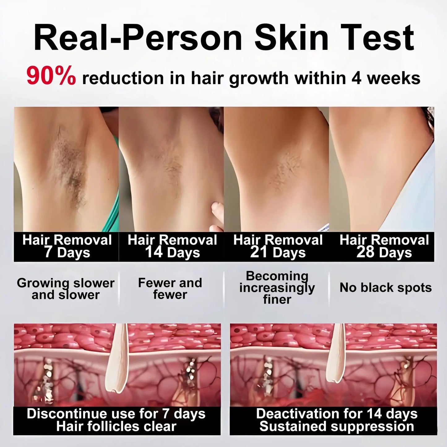 Ipl Hair Removal Device | 1200Nm Wavelength | Sapphire Cooling | Whole Body