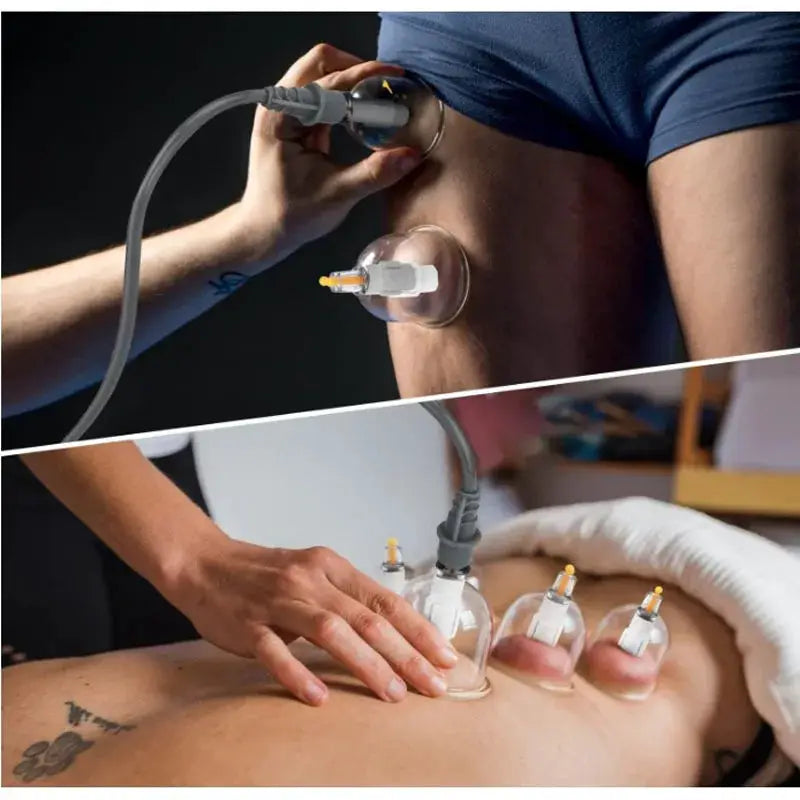 24 Pc Massage Cupping Set | Vacuum Therapy Cups With Hand Pump