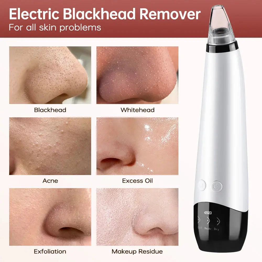 Electric Blackhead Remover Vacuum Acne Cleaner Black Spots Removal Facial Deep Cleansing Pore Cleaner Machine Skin Care Tools from PriceLows™