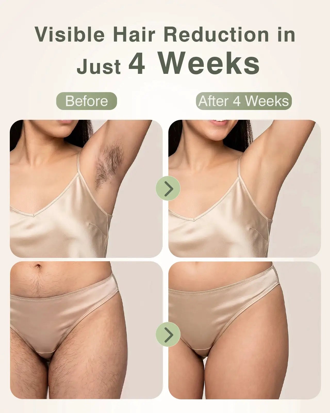 Ipl Hair Removal Device | 999k Flashes Ice Cooling | Women Home Epilator