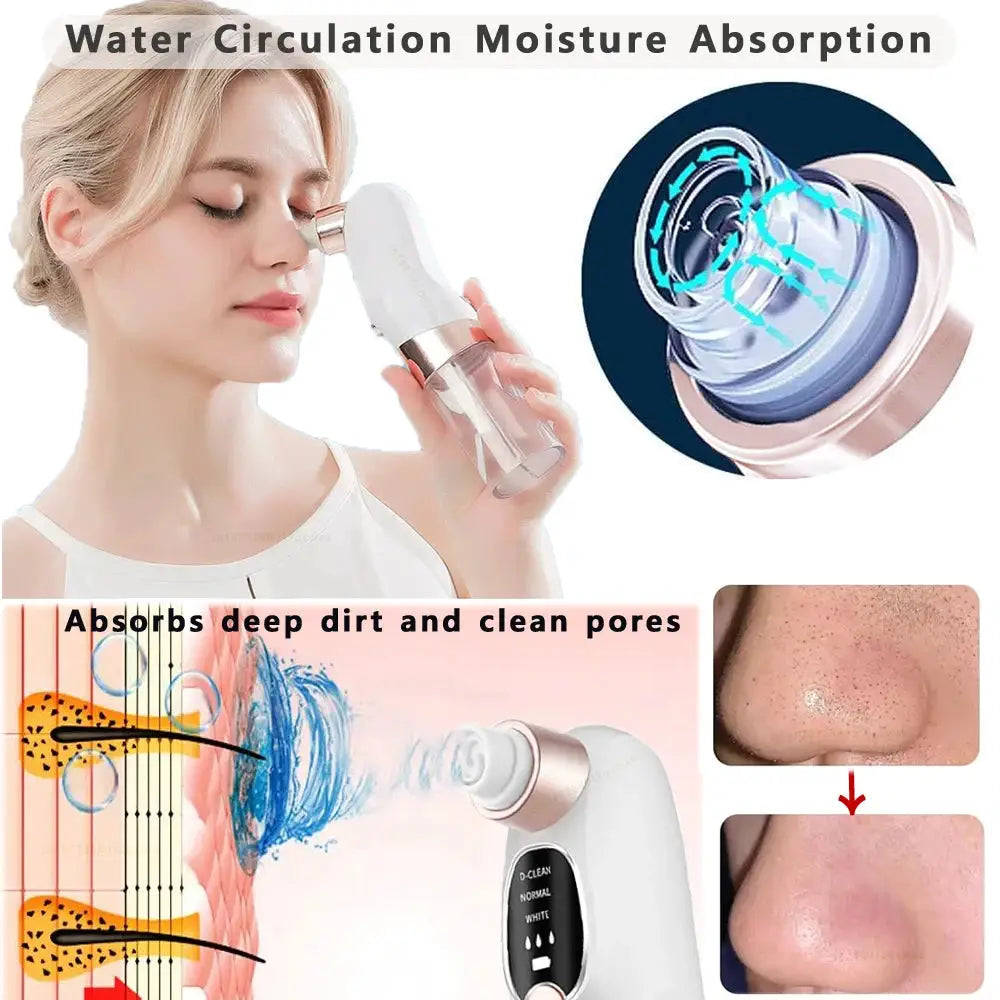 Blackhead Remover Pore Vacuum Face Cleaner Electric Pimple Acne Black Head Removal USB Rechargeable Water Cycle Black Dot Remove from PriceLows™