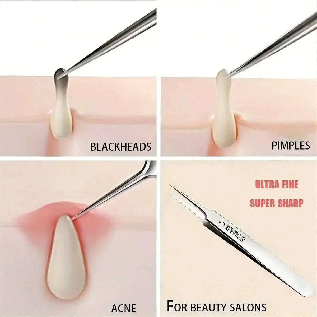 Fine Needle Tweezers | Stainless Steel | Blackhead Acne Pore Remover