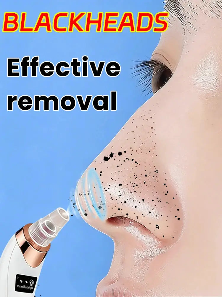 Electric Blackhead Remover Vacuum Pore Cleaner Deep Cleaning Acne Suction Facial Skin Care Beauty Tool from PriceLows™