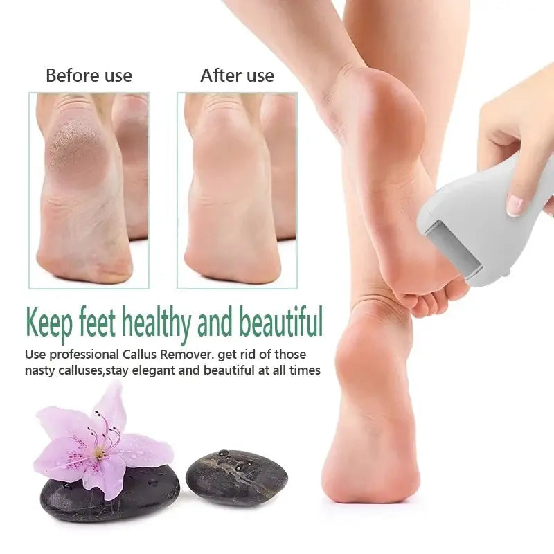 Electric Pedicure Foot File USB Rechargeable Power Display 3pcs Grinding Exfoliator Replacement Heads For Heel Callus Remover from PriceLows™