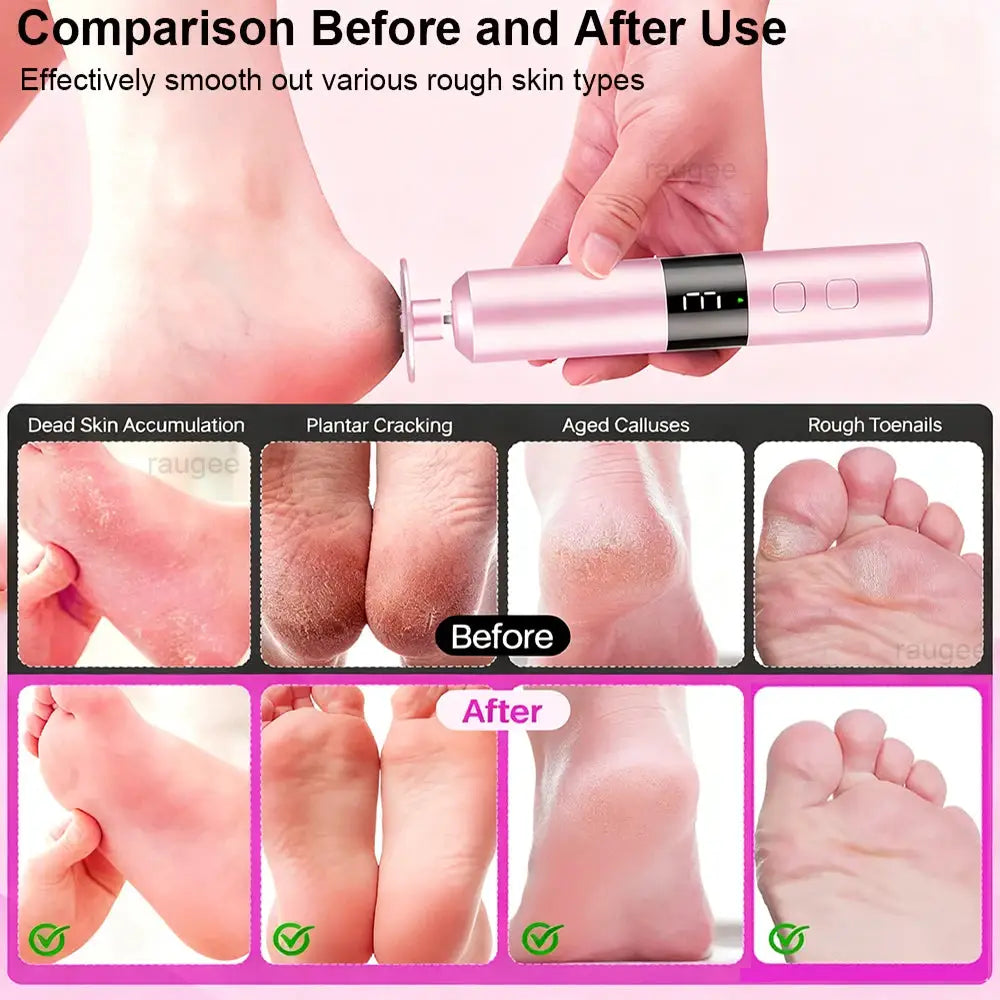 Electric Foot Grinder Rechargeable Foot Callus Predicure Remover Heels Dead Skin Grinding Machine Nails Gel Foot File Remover from PriceLows™