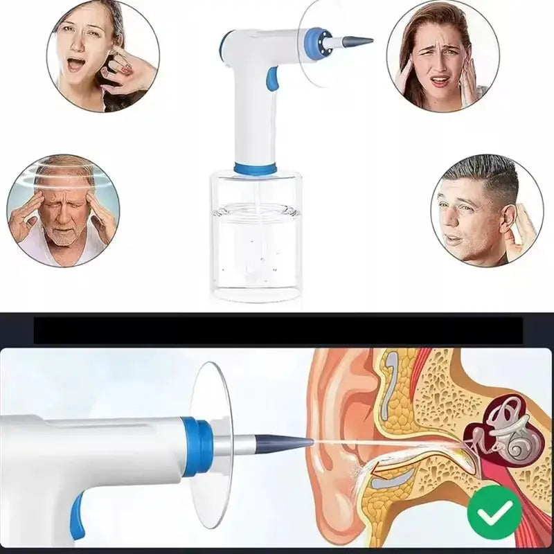 Electric Ear Cleaner with 4 Pressure Mode Electric Ear Cleaning Kit with 500ml Capacity Water TankWater Powerd Earwax Removal from PriceLows™