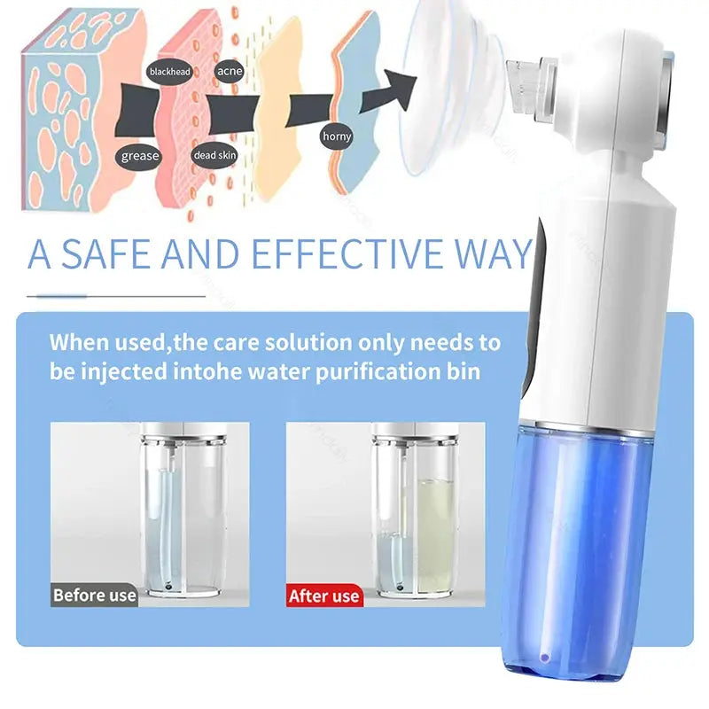 2025 New Blackhead Remover Pore Vacuum With Hot Compress Electric Facial Hydrating Cleaner Pimple Extractor Face Beauty Device from PriceLows™