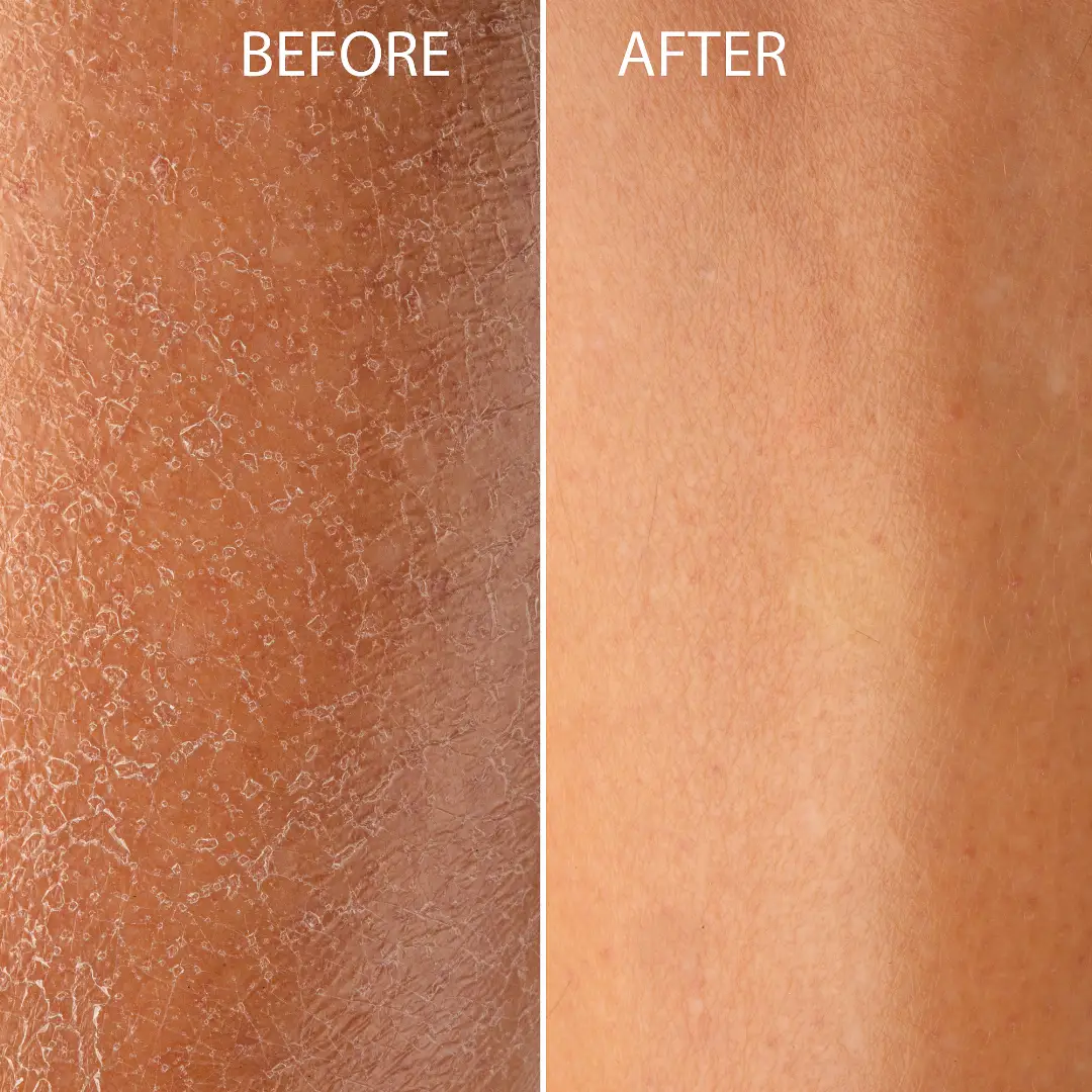 Cellular Renewal Methylene Blue Body Lotion from PriceLows™